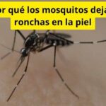 Por qué los mosquitos dejan ronchas en la piel