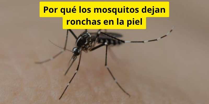 Por qué los mosquitos dejan ronchas en la piel